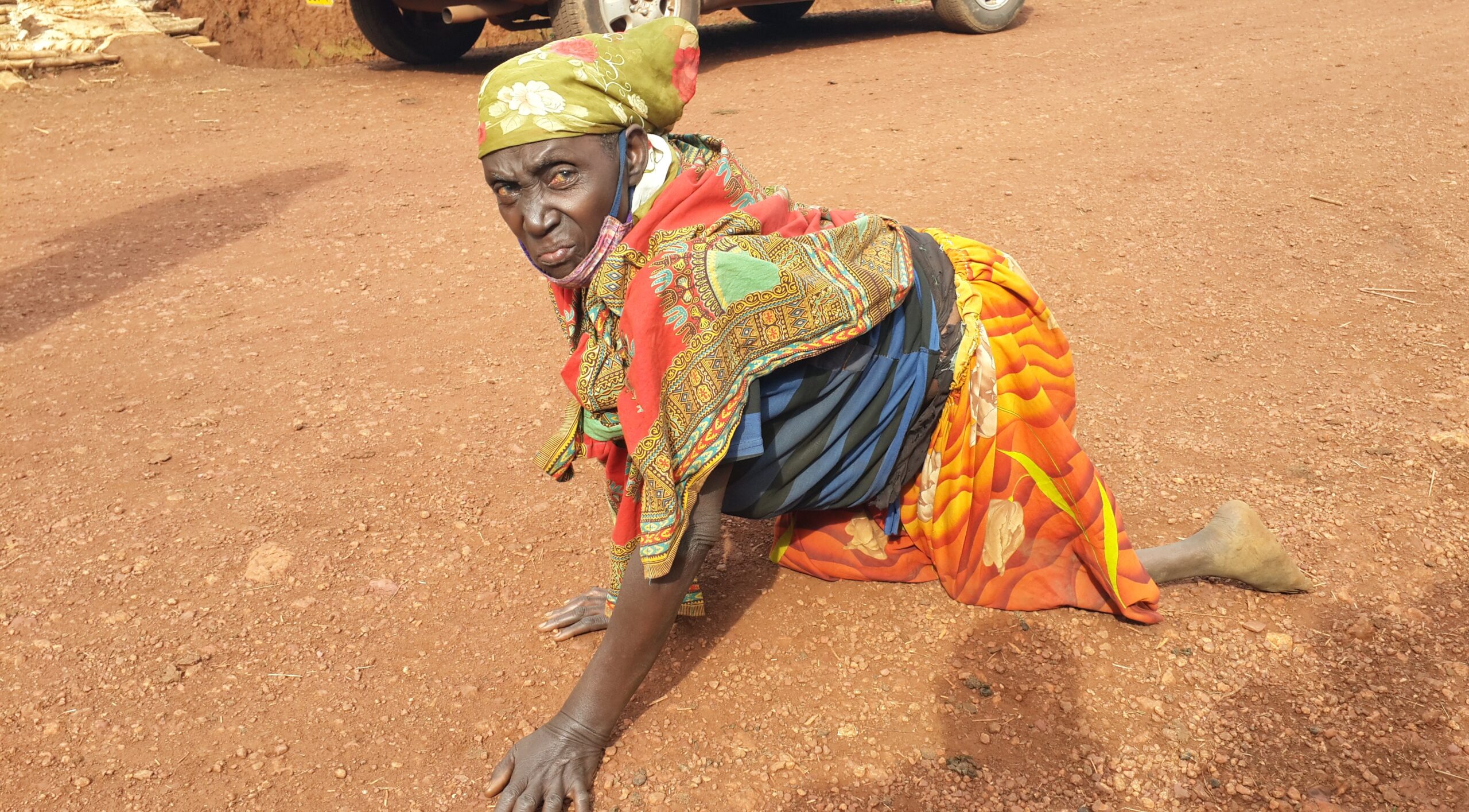 Ngoma: Abantu basaga 150 bafite ubumuga bw’ingingo bakeneye amagare